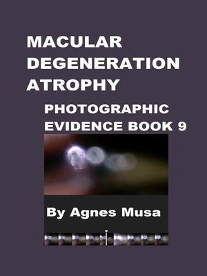 cover image of Macular Degeneration Atrophy, Photographic Evidence Book 9